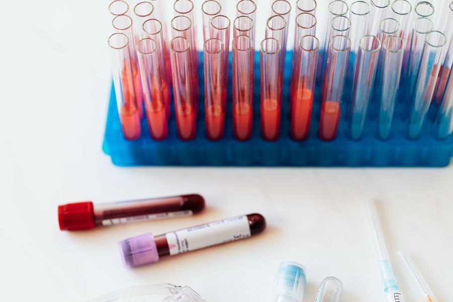 Rack of blood-collection test tubes with red and purple-capped vials and a syringe on a clean lab bench, representing functional lab testing and bloodwork.